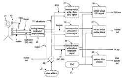 Method and system for processing data from ambulatory physiological monitoring