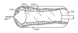 PERFUSION CATHETERS AND RELATED METHODS