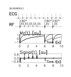 Systems and methods for shortened look locker inversion recovery (Sh-MOLLI) cardiac gated mapping of T1