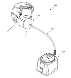 DISTINGUISHING BETWEEN CENTRAL AND OBSTRUCTIVE SLEEP APNEA