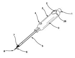 Tenodesis implant and inserter and methods for using same