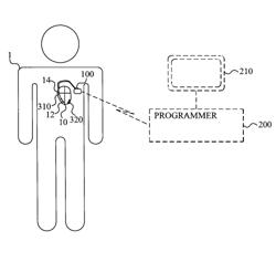 METHOD AND DEVICE FOR ESTIMATING A MYOCARDIAL PERFORMANCE PARAMETER