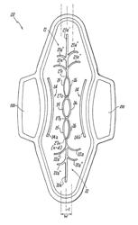 ABSORBENT ARTICLE DEMONSTRATING CONTROLLED DEFORMATION AND LONGITUDINAL FLUID DISTRIBUTION