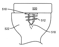 Instruments for knee placement