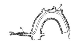 Segmented Catheter Structure and Improved Catheter Tip and Related Systems, Methods, and Devices