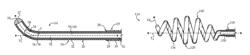 Treatment fluid delivery method, and turbulator for promoting uptake of a treatment agent