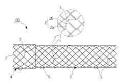 METHOD OF MANUFACTURING ANTI-MIGRATION STENT AND STENT MANUFACTURED THEREBY