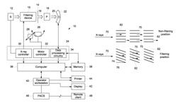 Systems and methods for X-ray imaging