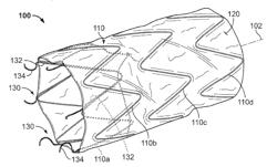 Intralumenal Stent Graft Fixation