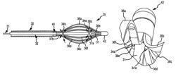 Non-contact electrode basket catheters with irrigation