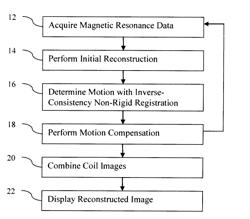 Motion compensated magnetic resonance reconstruction in real-time imaging