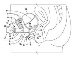 URINARY FLOW CONTROL DEVICE AND METHOD