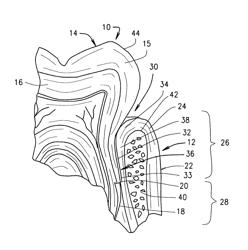 DIRECT MEDICAMENT PERIODONTAL DELIVERY METHOD AND ASSEMBLY FOR REDUCTION OF THE SYSTEMIC INFLAMMATORY MARKERS