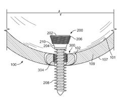 Acetabular cup fixation