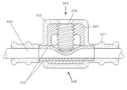 Torque lock anchor and methods and devices using the anchor