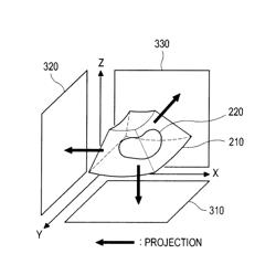 Arranging a three-dimensional ultrasound image in an ultrasound system