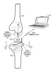 Muscular-Skeletal Joint Stability Detection and Method Therefor