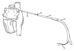 Transition apparatus for use with a medical device having an elongate element