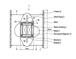 Axial-flow blood pump