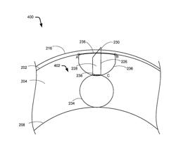 Delivery devices and related methods of use