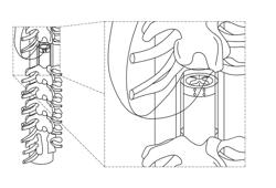 EPIDURAL STIMULATION FOR FACILITATION OF LOCOMOTION, POSTURE, VOLUNTARY MOVEMENT, AND RECOVERY OF AUTONOMIC, SEXUAL, VASOMOTOR, AND COGNITIVE FUNCTION AFTER NEUROLOGICAL INJURY