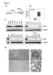 Compositions, Kits, and Methods for the Modulation of Immune Responses Using Galectin-1