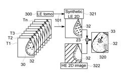 METHOD AND SYSTEM FOR OBTAINING LOW DOSE TOMOSYNTHESIS AND MATERIAL DECOMPOSITION IMAGES