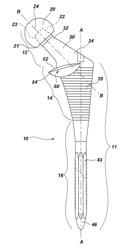 INTRINSIC STABILITY IN A TOTAL HIP STEM