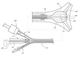 Methods for performing a medical procedure