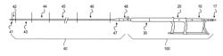 Implantation system with handle and catheter and method of use thereof