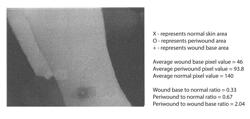 Grayscale Thermographic Imaging