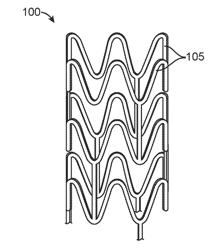 MAGNESIUM ALLOY IMPLANTS WITH CONTROLLED DEGRADATION