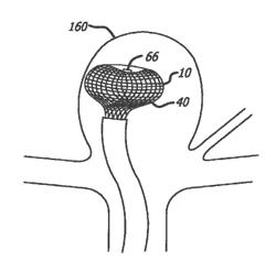 MULTIPLE LAYER FILAMENTARY DEVICES FOR TREATMENT OF VASCULAR DEFECTS