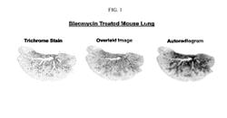 RADIOLIGANDS FOR IMAGING THE LPA-1 RECEPTOR