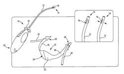 Surgical articles and methods