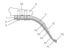 Layered soft palate support and implantation method