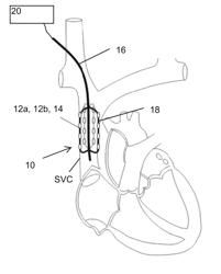 System and method for neuromodulation