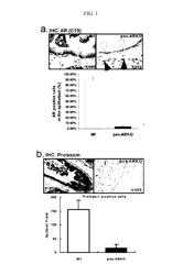 Methods for treating prostate cancer