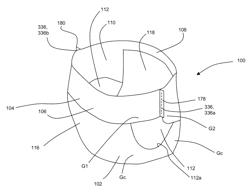 Methods for Making Diaper Pants with a Design Having a Discontinuous Region between a Belt and Chassis Arranged to Provide a Contiguous Appearance