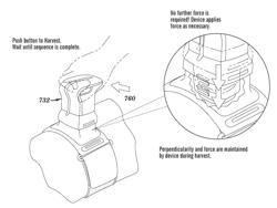 Method and System for Harvesting Biological Tissue