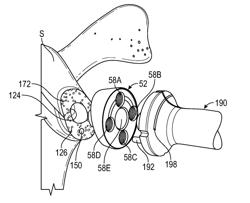 PATIENT-SPECIFIC AUGMENTED GLENOID SYSTEMS AND METHODS