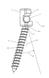 Implant for osseous anchoring with polyaxial head