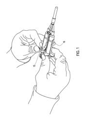 Method of arthroscopic osteochondral resurfacing using PRP strengthened with fibrin glue