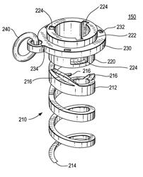 Soft body tissue remodeling methods and apparatus