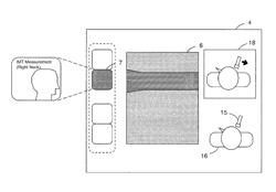 Ultrasound diagnostic apparatus and ultrasound diagnostic system