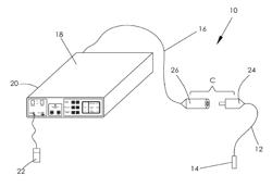 Method and system for destroying of undesirable formations in mammalian body