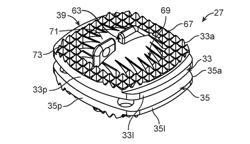 ANATOMY ACCOMODATING PROSTHETIC INTERVERTEBRAL DISC WITH LOWER HEIGHT