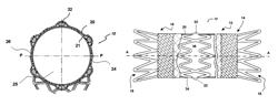 Flexible stretch stent-graft