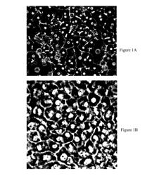 Method of deriving mature hepatocytes from human embryonic stem cells