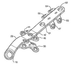 LATERAL ANKLE FUSION PLATE SYSTEM AND JIG, AND METHOD FOR USE THEREWITH